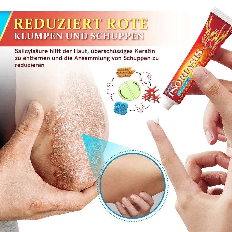 Furzero PsoriaKing Psoriasis Antibakterielle Behandlungscreme