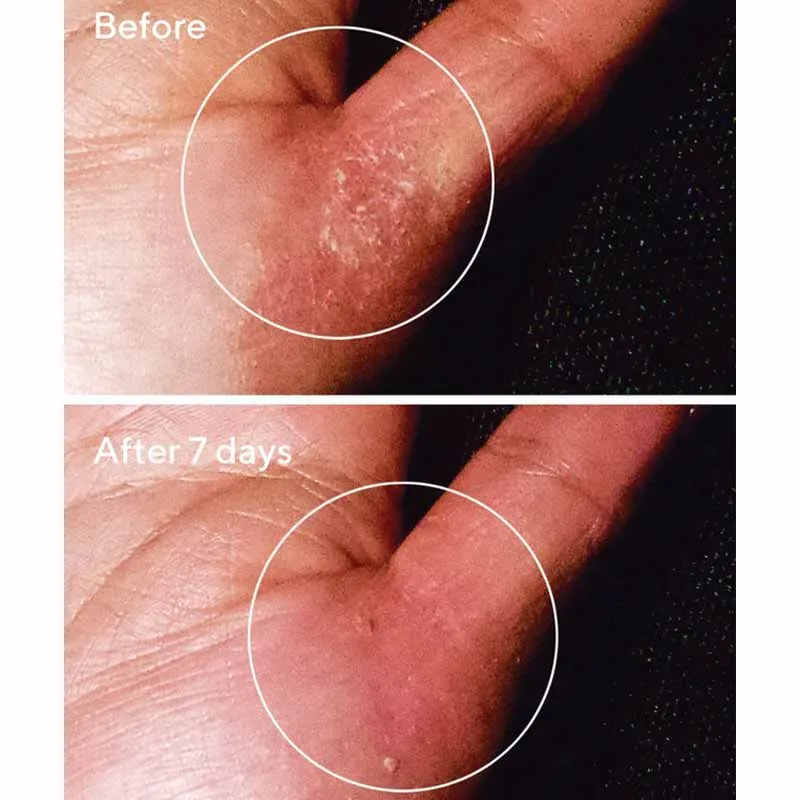Murad Exasoothe Quick Relief Moisture Treatment